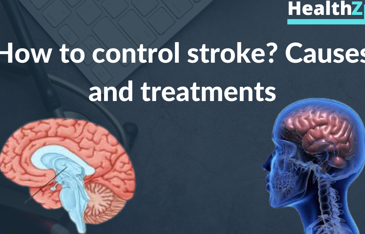 How to control stroke?