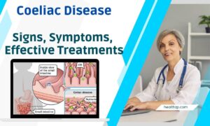 Coeliac Disease Signs, Symptoms, Effective Treatments